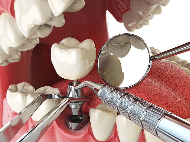 Best Emergency TMJ Treatment in Heritage Pines, FL
